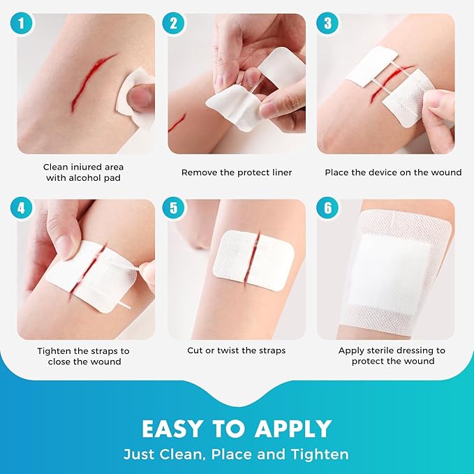 Zip Stitch Wound Closure Strips | 4-Pack Stitchless Butterfly Bandages | Adjustable Tension for Painless Laceration Repair, Post-Surgery Care & Emergency First Aid