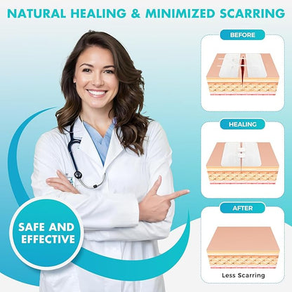 Zip Stitch Wound Closure Strips | 2-Pack Stitchless Butterfly Bandages | Adjustable Tension for Painless Laceration Repair, Post-Surgery Care & Emergency First Aid