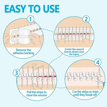 Large Butterfly Bandages for Extra Large Wounds | FSA/HSA Eligible Steri Strips Wound Closure - Surgical-Grade Stitch-Free Laceration Repair & Rapid Hemostasis, Emergency First Aid Care