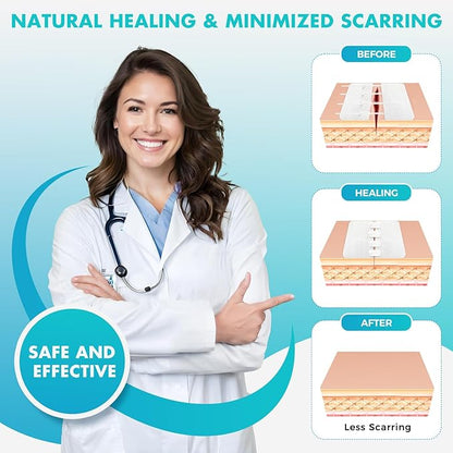 Zip Stitch Wound Closure Strips Extra Large | 2-Pack Stitchless Butterfly Bandages | Adjustable Tension for Painless Laceration Repair, Post-Surgery Care & Emergency First Aid