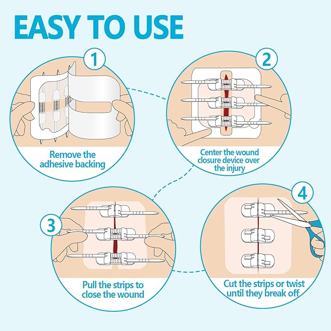 Wound Closure Strips - 4 Pcs Butterfly Bandaids Extra Large Emergency Laceration Closures Kits Bandages for Big Wound Care, Hospital Grade Rapid Skin Closure for Home, Outdoor