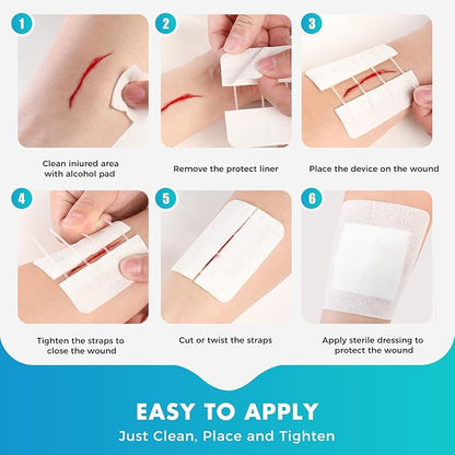 Zip Stitch Wound Closure Strips Extra Large | 2-Pack Stitchless Butterfly Bandages | Adjustable Tension for Painless Laceration Repair, Post-Surgery Care & Emergency First Aid